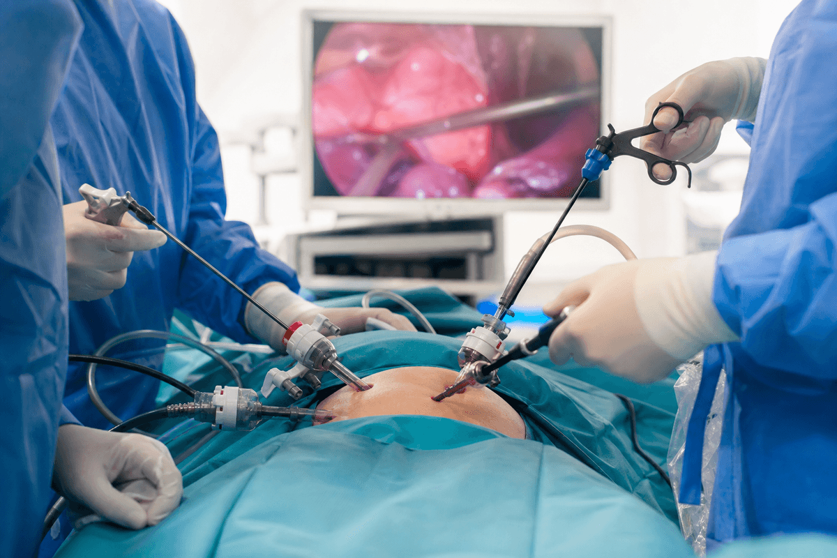 Colorectal Cancer Surgery